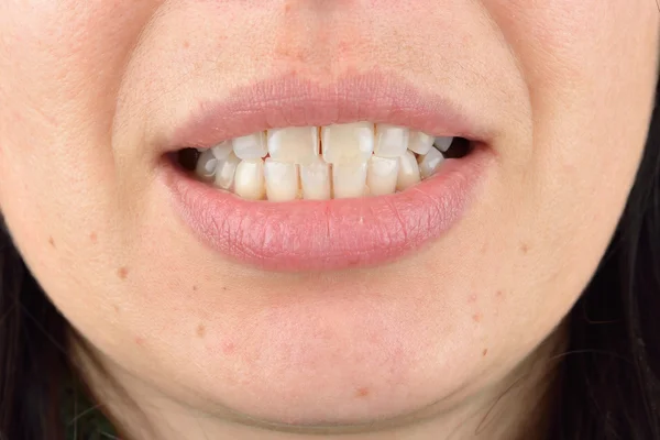 Gros plan des dents saines de la jeune femme. Soins dentaires. Hy ! — Photo