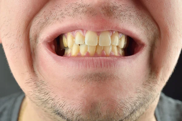 그의 이빨을 보여주는 남자의 자세한 이미지입니다. 치과 건강 관리입니다. Hyg — 스톡 사진