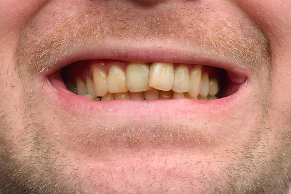 그의 이빨을 보여주는 남자의 자세한 이미지입니다. 치과 건강 관리입니다. Hyg — 스톡 사진
