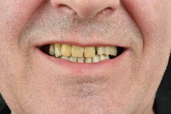 Imagem detalhada do homem a mostrar os dentes. Assistência médica dentária. Hig — Fotografia de Stock
