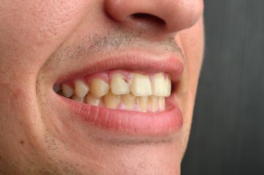 Adamın dişlerini gösteren ayrıntılı görüntü. Dişlerle ilgili sağlık kaygı. Hijyen. Diş Hekimliği