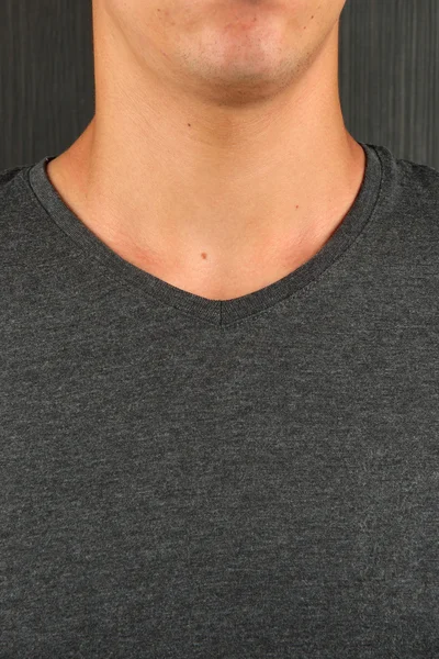 Caucasian young man in grey t-shirt with a birthmark on his neck — Stock Photo, Image