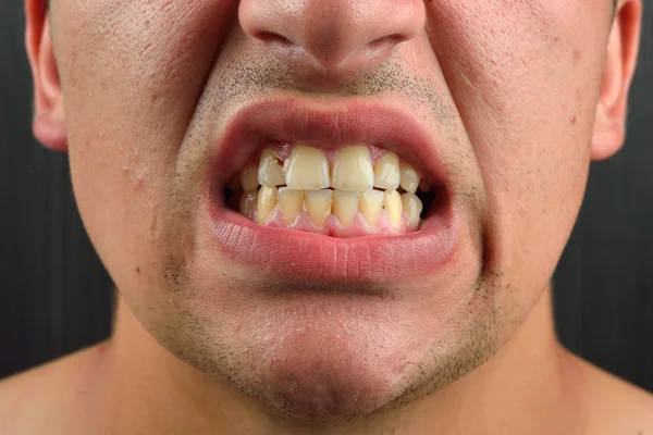 Детальне зображення людини, що показує зуби. Стоматологічна охорона здоров'я. Гігієна. стоматології — стокове фото