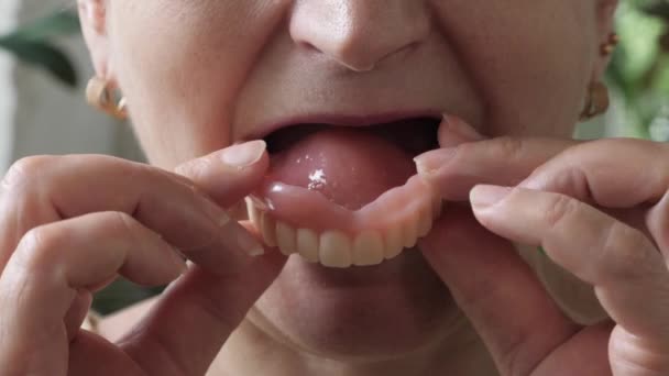 Inserção de dentaduras. Conceito dentário. Mulher usando prótese dentária — Vídeo de Stock