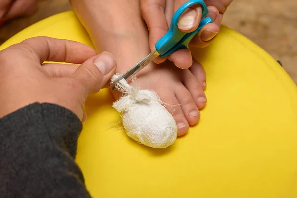 Flickans Händer Gjorde Ett Medicinskt Bandage Barnets Stortå Och Skar — Stockfoto