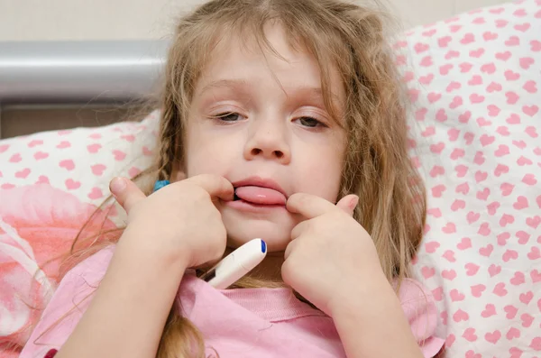 Diseased three year old girl showing tongue Stock Photo