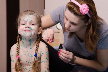 Anne Tavuk Pox'u yaralar zelenkoj küçük kızla özlüyor