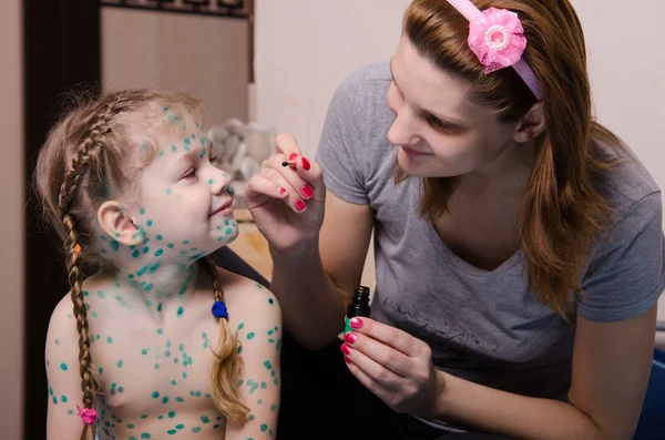 Mamãe sente falta da criança com varicela feridas zelenkoj — Fotografia de Stock