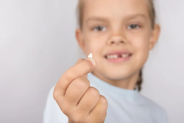 6-letnia dziewczyna pokazano jej poległych zęby przednie górne — Zdjęcie stockowe