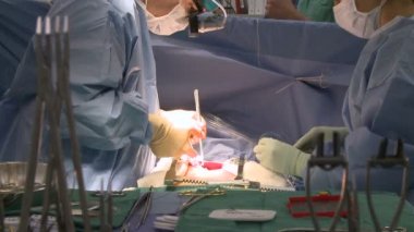 Cerrahlar bir tıbbi işlem gerçekleştirme