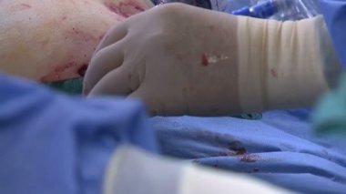 Cerrahlar hastanede tıbbi bir operasyonu