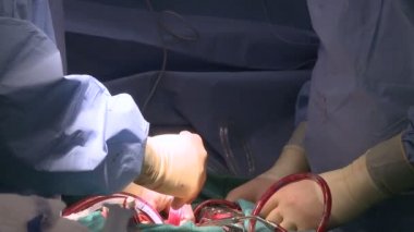 Tüpler kan kalbe pompalama bypass