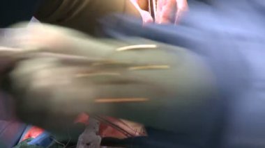 Ameliyat sırasında konumlandırılmış tüpler