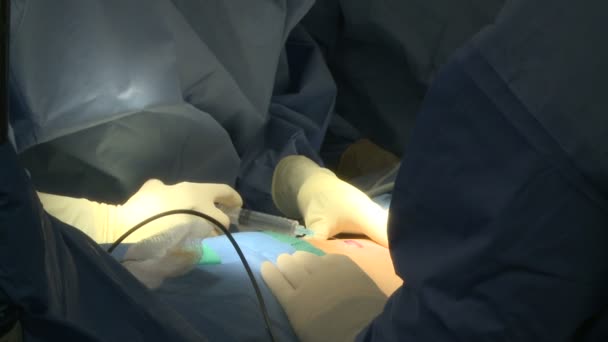 Chirurg administruje znieczulenia miejscowego — Wideo stockowe