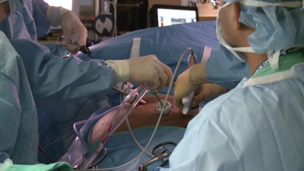 Cirurgiões realizando operação — Vídeo de Stock