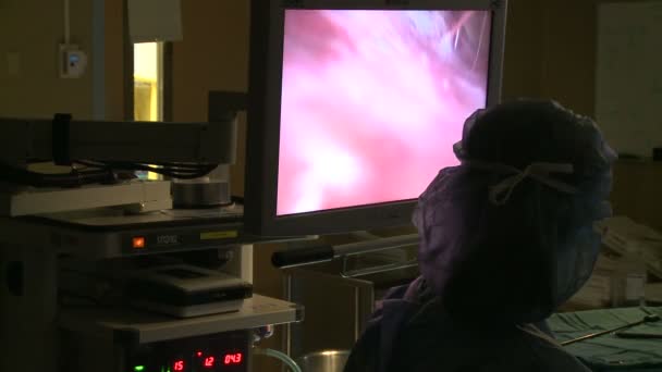 Laparoskopische Kamera zieht ein — Stockvideo