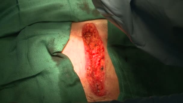 El corazón late a través de una incisión abierta — Vídeo de stock