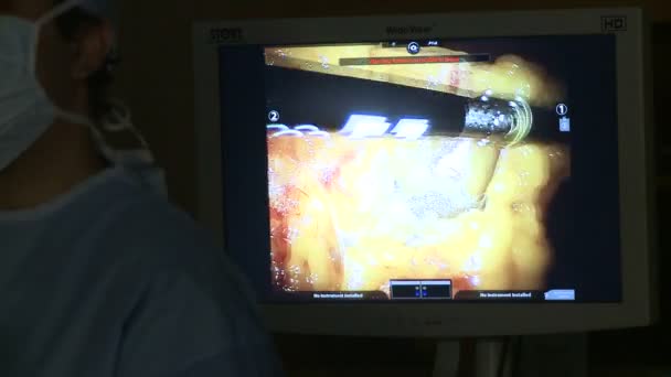 Ρομποτική χειρουργική επέμβαση της μήτρας — Αρχείο Βίντεο