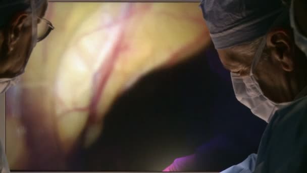 Хирурги, выполняющие роботизированную операцию — стоковое видео