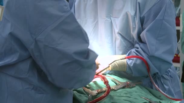 Chirurgów używających komórek ratownicze na serce pacjenta — Wideo stockowe