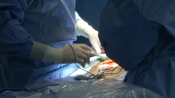 Chirurgen führen die Operation durch — Stockvideo