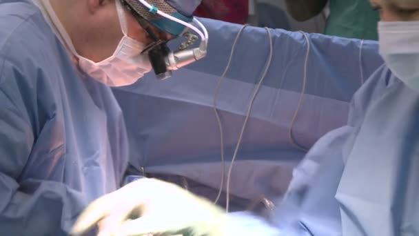Cirurgiões que realizam uma operação médica — Vídeo de Stock