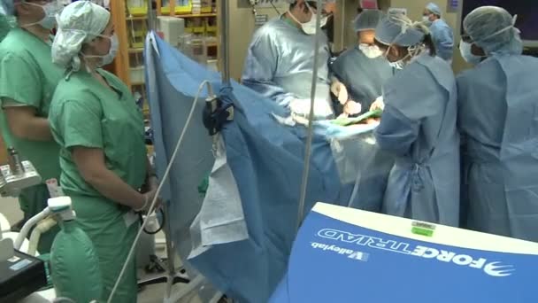 Kirurger som utför åtgärden — Stockvideo