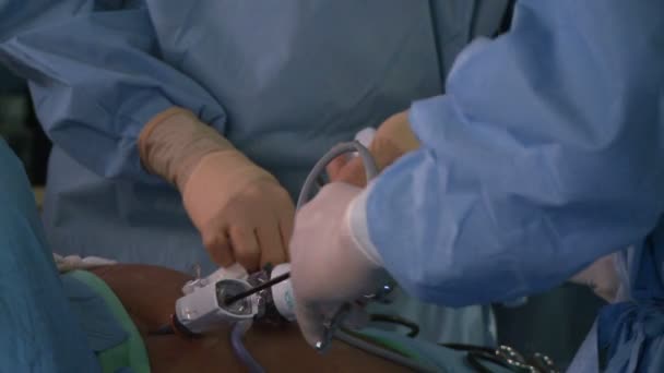 Cirurgiões realizando operação — Vídeo de Stock