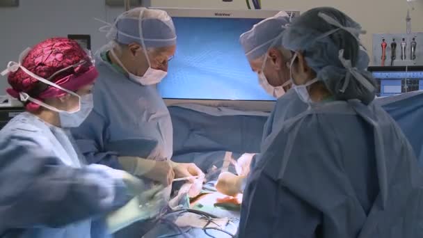 操作を実行する外科医 — ストック動画