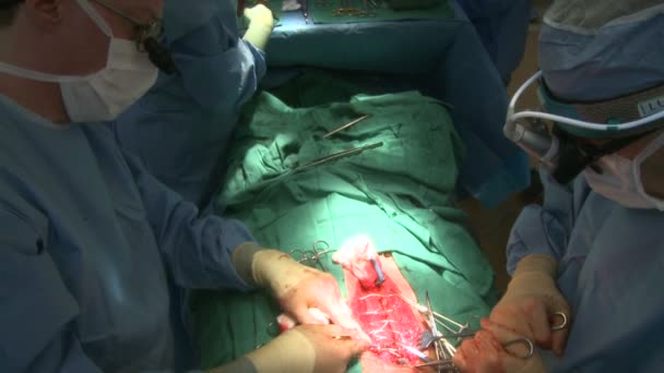 Cirujanos cosiendo operación de pecho — Vídeo de stock