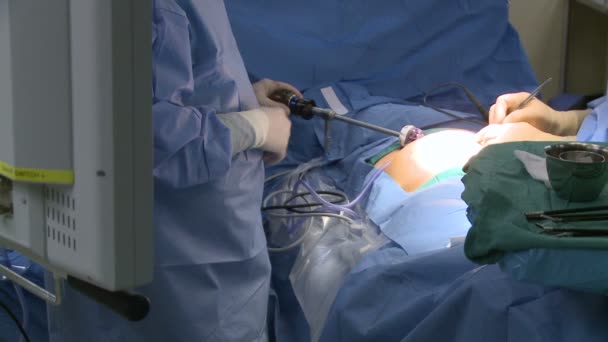Kirurger som utför en medicinsk åtgärd — Stockvideo