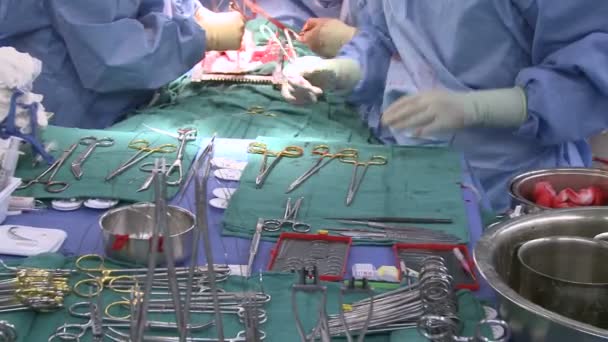 Chirurgiens effectuant une opération médicale — Video