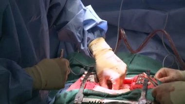 kalp ameliyatı sırasında doktor eller