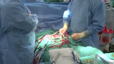 Cerrahlar kan akan izlemek