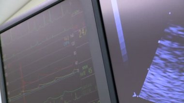 Hayati istatistikler monitör