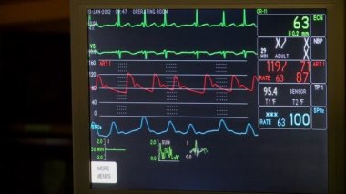 Vital bulguları tıbbi monitör