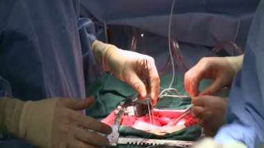 kalp ameliyatı sırasında doktor eller