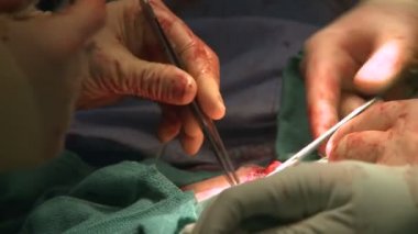 Cerrah karnı kadar dikiş