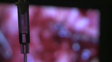 Laparoskopi sırasında IV damla