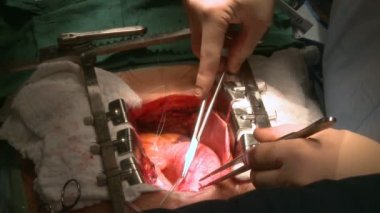 Kalp atım açık göğüs aracılığıyla