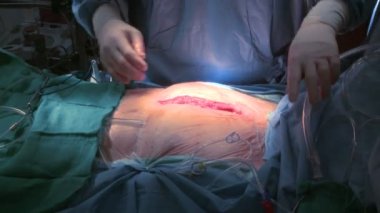 Cerrah kaburga geri çekilmesi için hazırlar