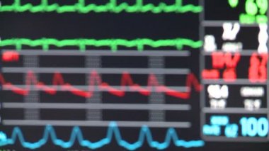 Vital bulguları tıbbi monitör