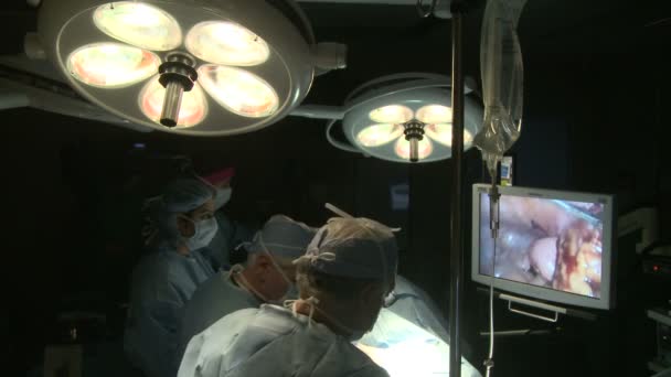 Хірурги, що виконують роботизовану операцію в лікарні — стокове відео