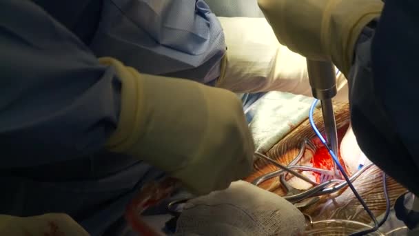 Види всередині типової лікарні хірургічної операційної кімнати — стокове відео