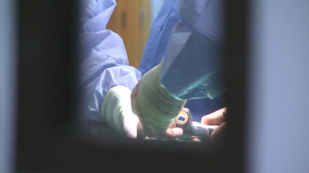 Cirujanos realizando una operación médica — Vídeos de Stock