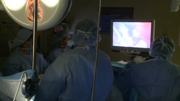 Equipo quirúrgico realiza laparoscopia — Vídeos de Stock