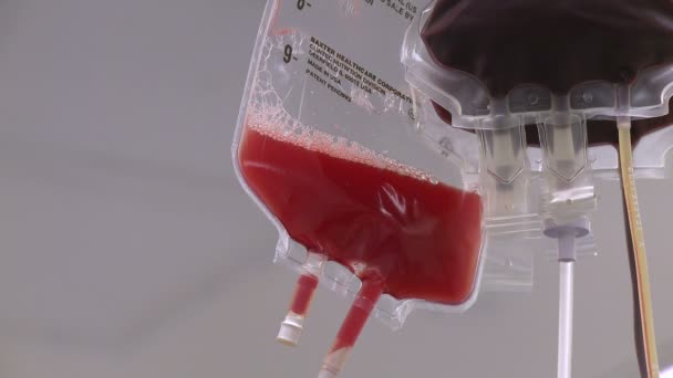 DRIP zakken tijdens chirurgie — Stockvideo