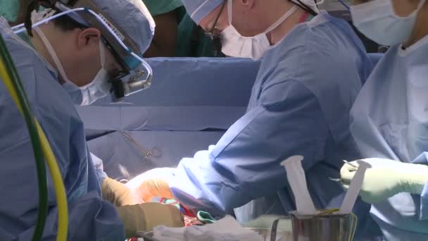 Les chirurgiens travaillent ensemble sur le patient cardiaque — Video