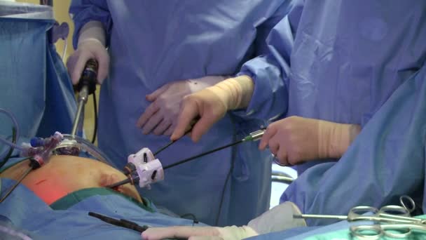 Surgeons performing a medical operation — Stock Video