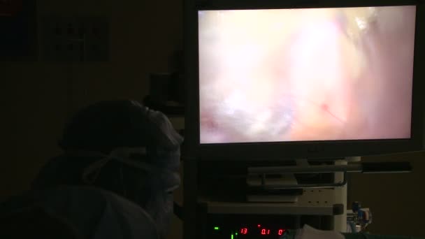 Laparoscopic camera moves into place — Stock Video